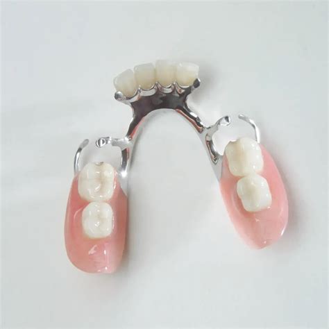 Ppr Acr Lica Soluci N Eficiente Para P Rdida Dental Polisantafe