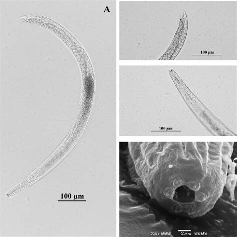 Light And Scanning Electron Microscopy Photographs Of Heterorhabditis