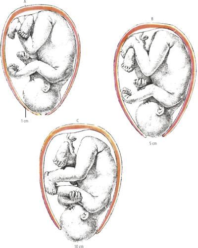 Parto Dizionario Medico Corriere It