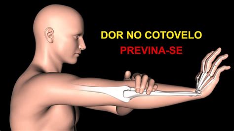 Epicondilite Exerc Cios Que Ajudam A Prevenir E Aliviar A Dor No