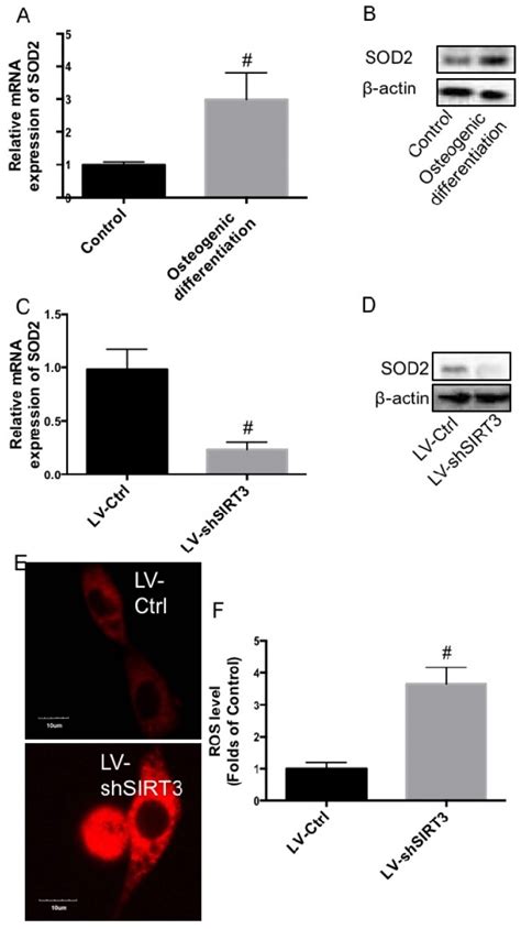 Effect Of Knockdown Of SIRT3 On SOD2 Expression And ROS Level MC3T3 E1