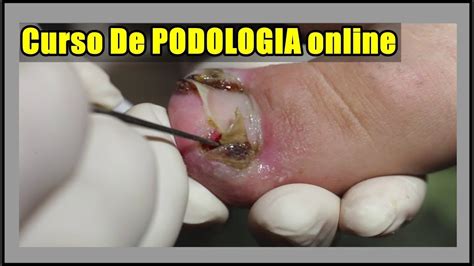 Curso De Podologia Online Curso Fórmula Podologia de Sucesso Curso