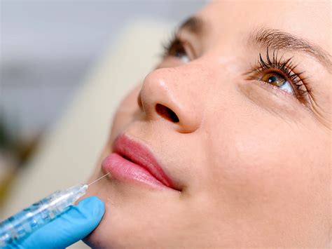 Vascular Occlusion Lip Filler Everything You Need To Know