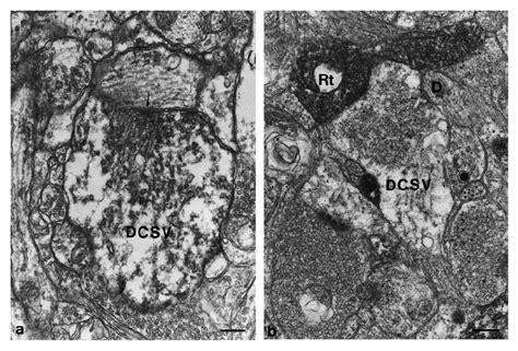 Gaba Immunoreactive Dendrites Containing Synaptic Vesicles Dcsvs A