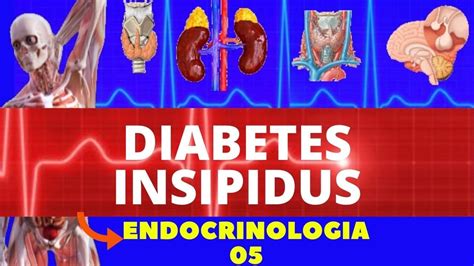 Diabetes Insipidus Causa Fisiopatologia DiagnÓstico E Tratamento Endocrinologia Youtube