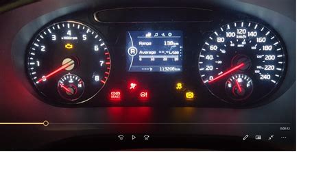 multiple warning light on dashboard | Kia Forum