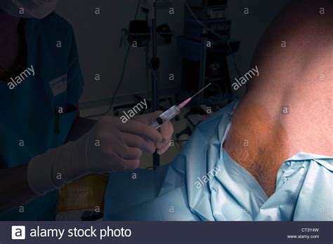 Peridural Anaesthesia Hi Res Stock Photography And Images Alamy