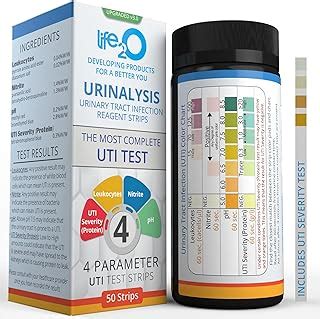 Understanding Creatinine Levels In Random Urine Samples | MedShun