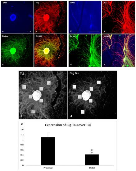 Cells Free Full Text Regulation Of Tau Expression In Superior