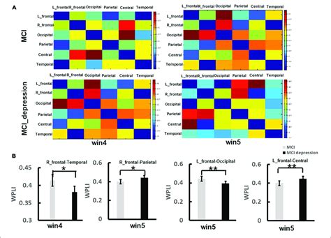 The Significant Difference Of Functional Connectivity Matrix Between