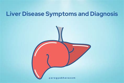 Liver Disease Symptoms and Diagnosis - Arogyabhava