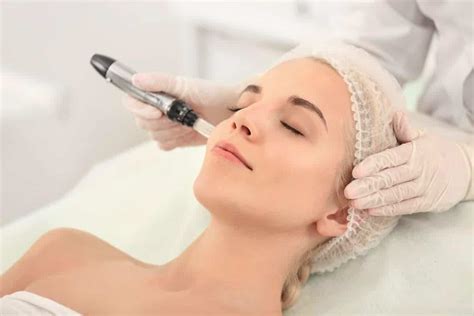 Qu Es Microneedling Tratamiento Facial Con Col Geno