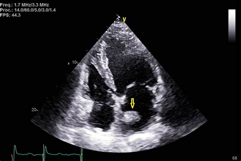 J Med Cases