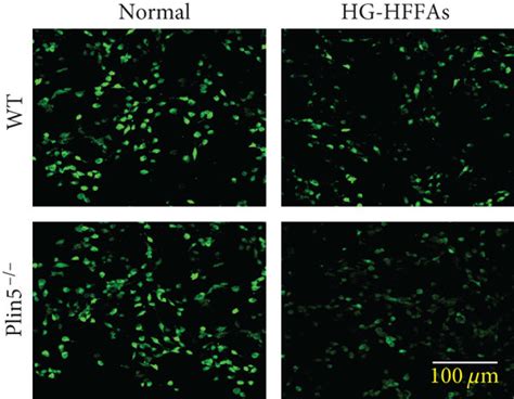 The Influence Of Plin Deficiency On Cmec Injury Induced By Hg Hffas