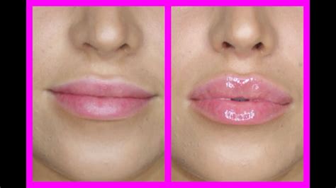 City Lips Lip Plumper Before After