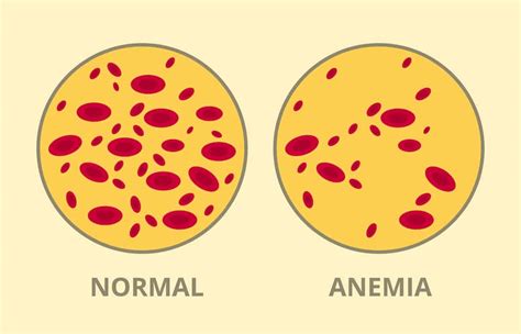 The 9 Best Ways To Increase Hematocrit Levels 2024