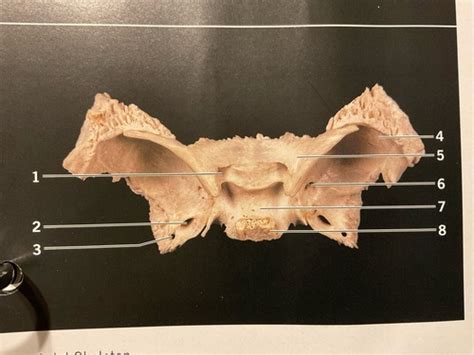 Sphenoid Bone Flashcards Quizlet