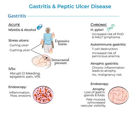 Clinical Pathology Glossary Gastritis And Peptic Ulcer Disease Ditki