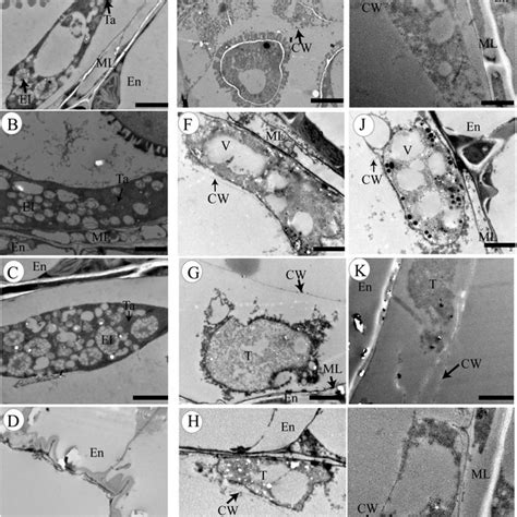 Transmission Electron Micrographs Of Anthers From The Wild Type And