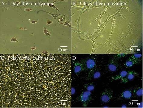 Phase Contrast Micrograph Of Hrpe Cells Primary Culture Morphologies