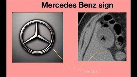 Mercedes Benz Sign Radiology Spotter Medicine Spotter Osce