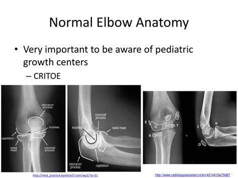 Ppt Elbow Trauma Powerpoint Presentation Free Download Id1083213