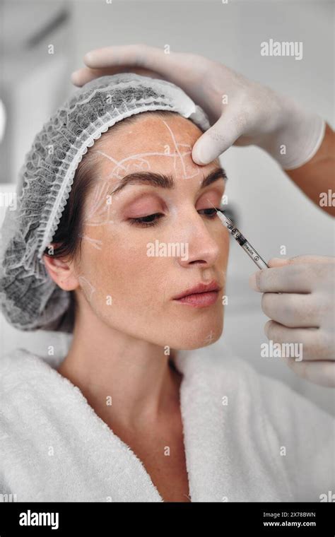 Botulinum Therapy Correction Of Mimic Wrinkles Stock Photo Alamy