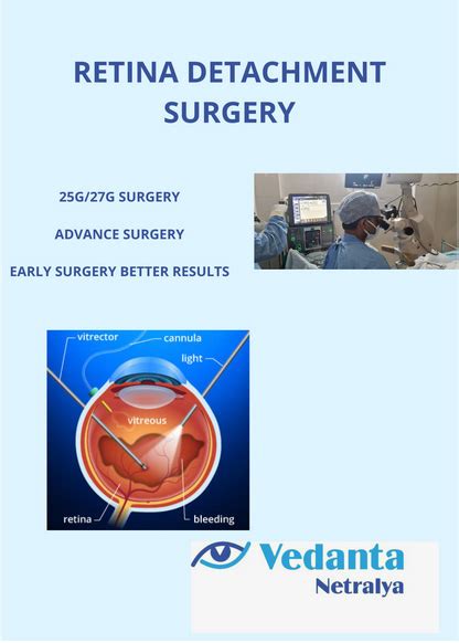 Retina Detachment Surgery Vedanta Netralya