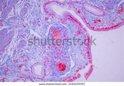 Columnar Epithelium Human Gall Bladder Under Stock Photo 2160239101