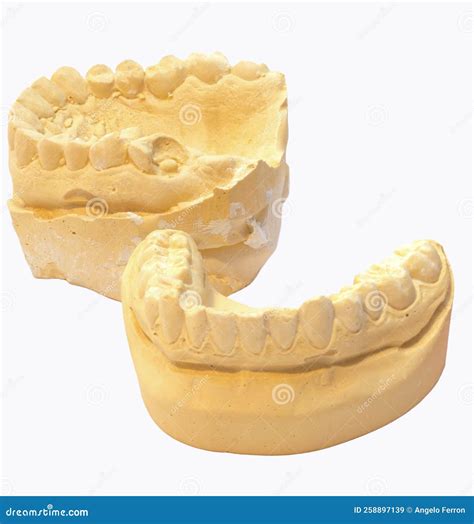 Plaster Impression Of Teeth Dental Plaster Mold Dental Mold Showing