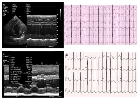 Echocardiographic Images And Ecgs Cardiac Ultrasounds Of Patient