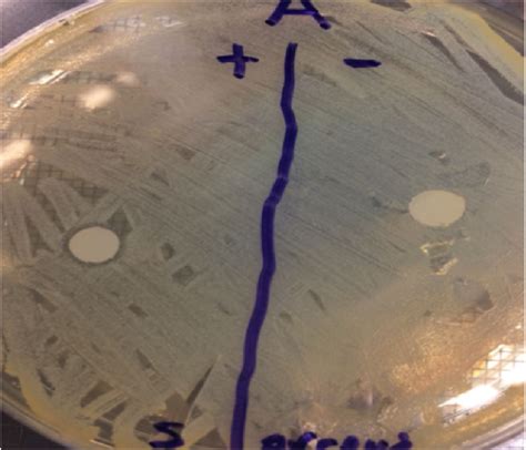 Disc Diffusion Assay For Ag Nps Via Walnut Shell Powder With S Aureus Download Scientific