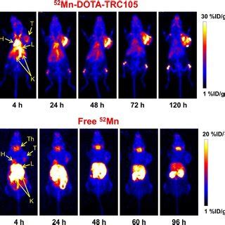 Serial Maximum Intensity Projection Mip Positron Emission Tomography