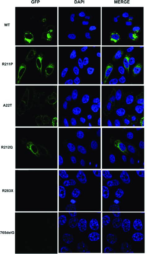 Subcellular Localization Of Wild Type And Mutant Il R Proteins