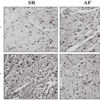 Expression Of Basic Fibroblast Growth Factor Bfgf And Hepatocyte