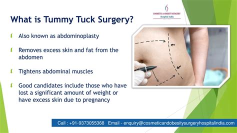 PPT Benefits Of Tummy Tuck Surgery PowerPoint Presentation Free