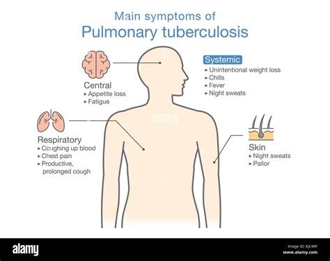 Lungs diagram hi-res stock photography and images - Alamy