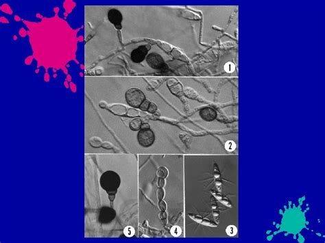 INTRODUCTION TO THE ASCOMYCETES IB 371 GENERAL MYCOLOGY