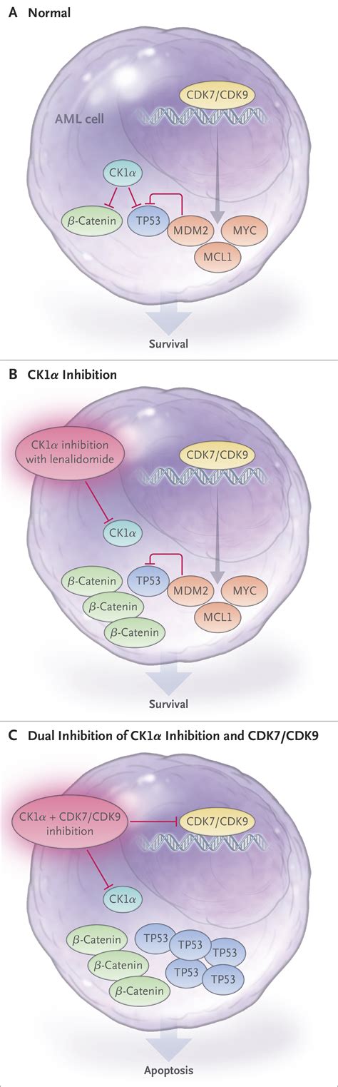 Inhibition Of Casein Kinase 1 Alpha In Acute Myeloid Leukemia Nejm