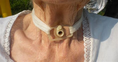 Tracheostomy Collar Types Uses And Care Tips