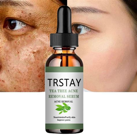 5ML 15ML 30ML 50ML Acne Treatment Face Serum Tea Tree Oil Essence