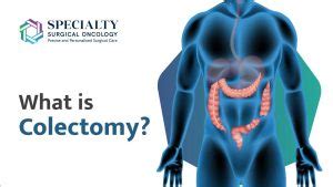 Understanding the Purpose and Procedure of Colectomy