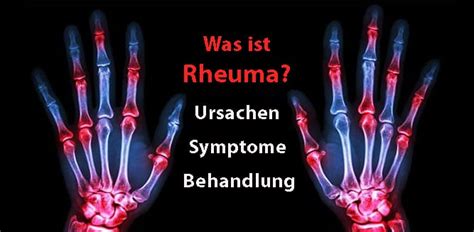 Was Ist Rheuma Ursachen Symptome Und Behandlung