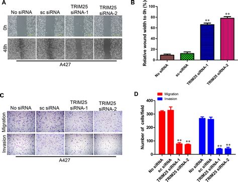 Overexpression Of TRIM25 In Lung Cancer Regulates Tumor Cell