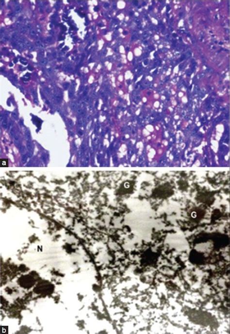 A Photomicrograph Showing Section Stained With Periodic Acid Schiff