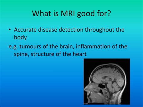 Ppt Medical Imaging Powerpoint Presentation Free Download Id 3006805