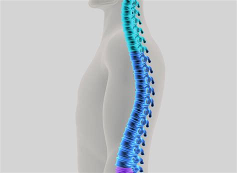 SCOLIOSIS [spinal deformity] - The Private Clinic