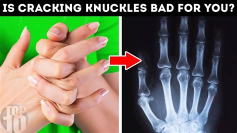 What Happens When You Crack Your Knuckles Youtube