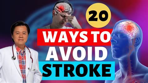 20 Ways To Avoid A Stroke By Doctor Willie Ong Cardiologist