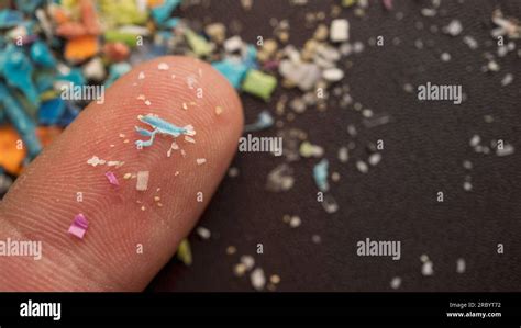 Macro Picture Of Microplastic Particles And Sand Grains On A Human